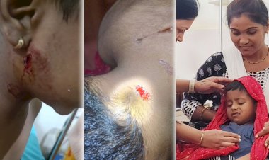 Bibttya attack | चिमुकल्यावर हल्ला, आईच्या धैर्यामुळे जीव वाचला